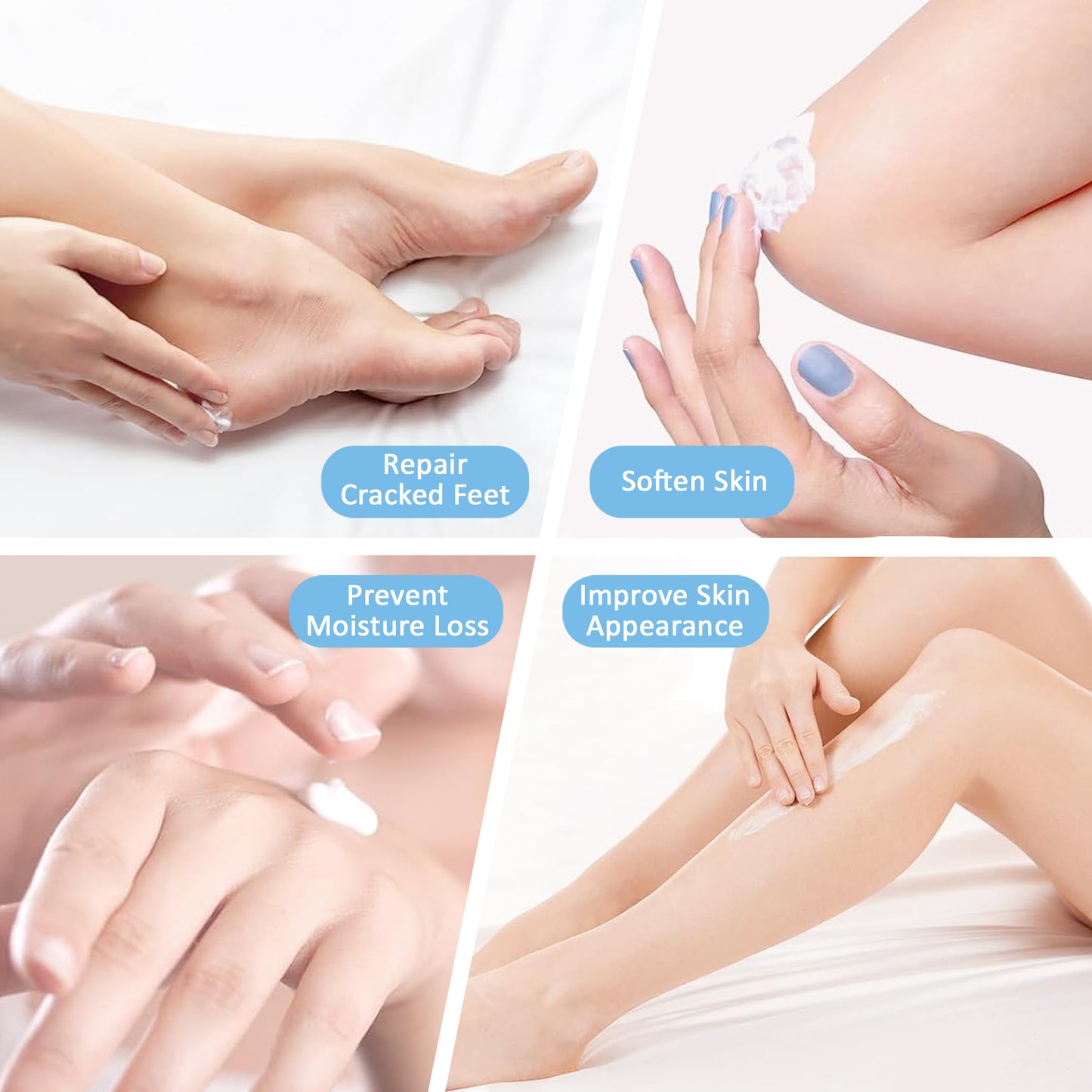 Urea Cream for Feet, Elbows, and Knees with 40% Urea
